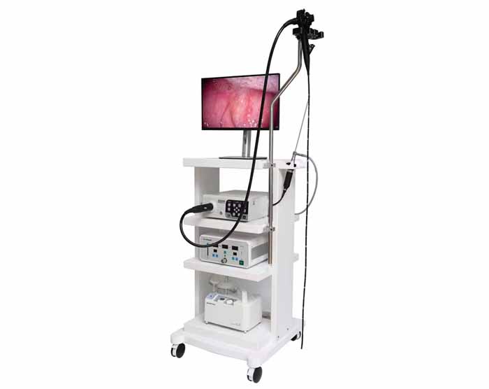 Endoscopie